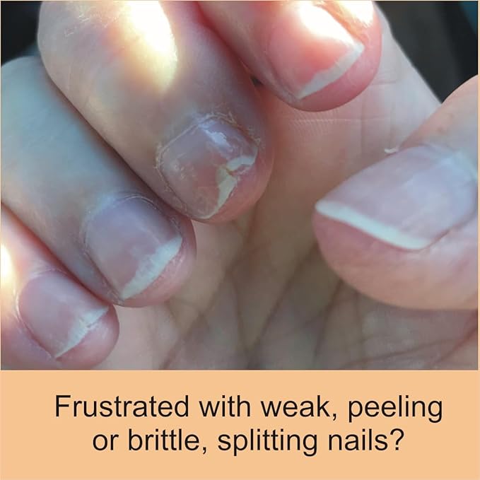 Penetrating Fingernail Conditioner and Strengthener to repair and then maintain weak and peeling or brittle and splitting nails