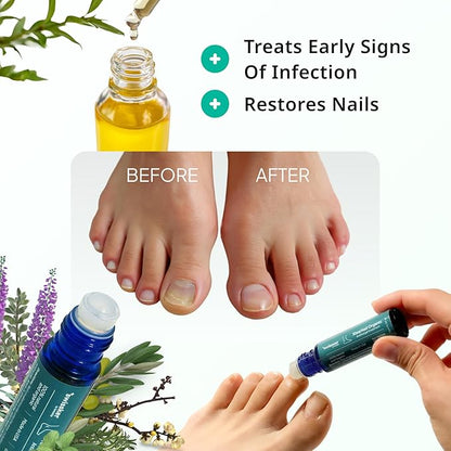 Swissklip KlearNail Toenail Stick | Medi-Care Treatment | Natural Solution for Healthy Nails I Suitable For Foot, Toe, and Fingernail I For Brittle Toenails – 10ml / 0.3 Fl. Oz. Pack 1 - Made in USA