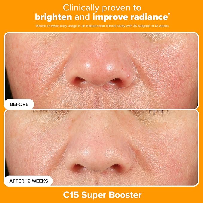 Paula's Choice Brighter Days Ahead Kit, Vitamin C and AHA Trio, Includes Travel Size C5 SPF Face Sunscreen, Mandelic Acid Exfoliant, C15 Vitamin C Booster Serum, Brightening & Resurfacing, 3-Piece Set