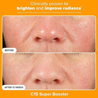 Paula's Choice Brighter Days Ahead Kit, Vitamin C and AHA Trio, Includes Travel Size C5 SPF Face Sunscreen, Mandelic Acid Exfoliant, C15 Vitamin C Booster Serum, Brightening & Resurfacing, 3-Piece Set