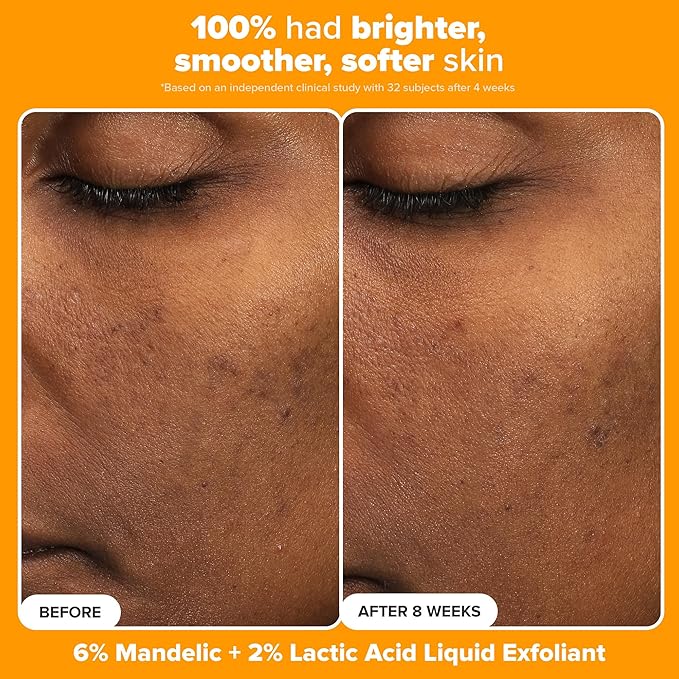 Paula's Choice Brighter Days Ahead Kit, Vitamin C and AHA Trio, Includes Travel Size C5 SPF Face Sunscreen, Mandelic Acid Exfoliant, C15 Vitamin C Booster Serum, Brightening & Resurfacing, 3-Piece Set